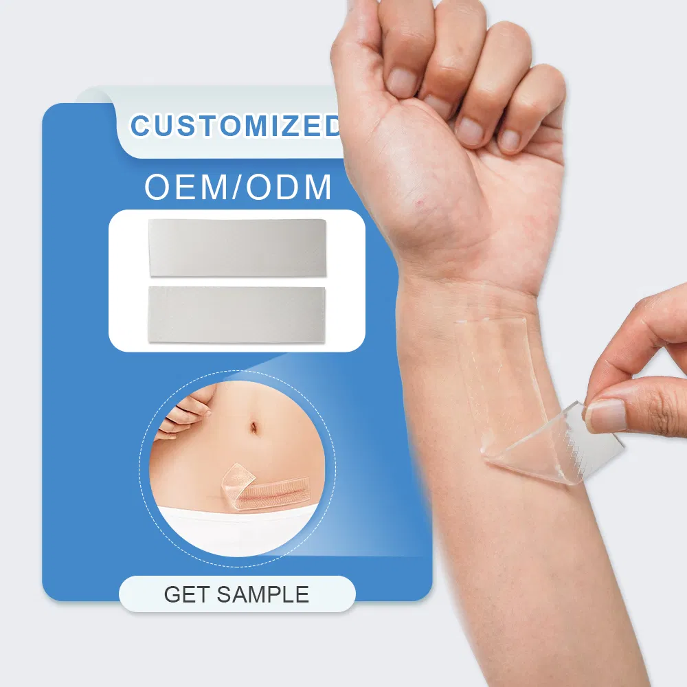 Silicone Gel Scar Patch 1