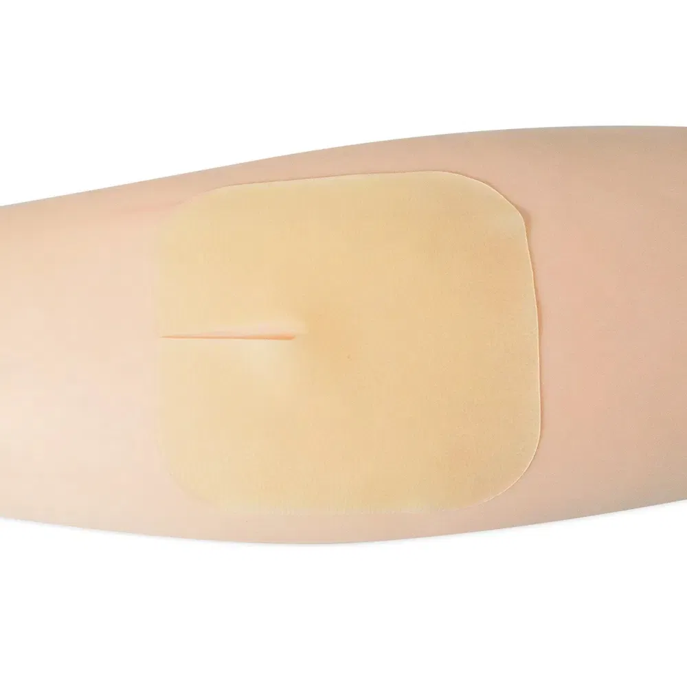 Hypoallergenic Ultra-Thin Hydrocolloid Dressing 6*7cm with U Port