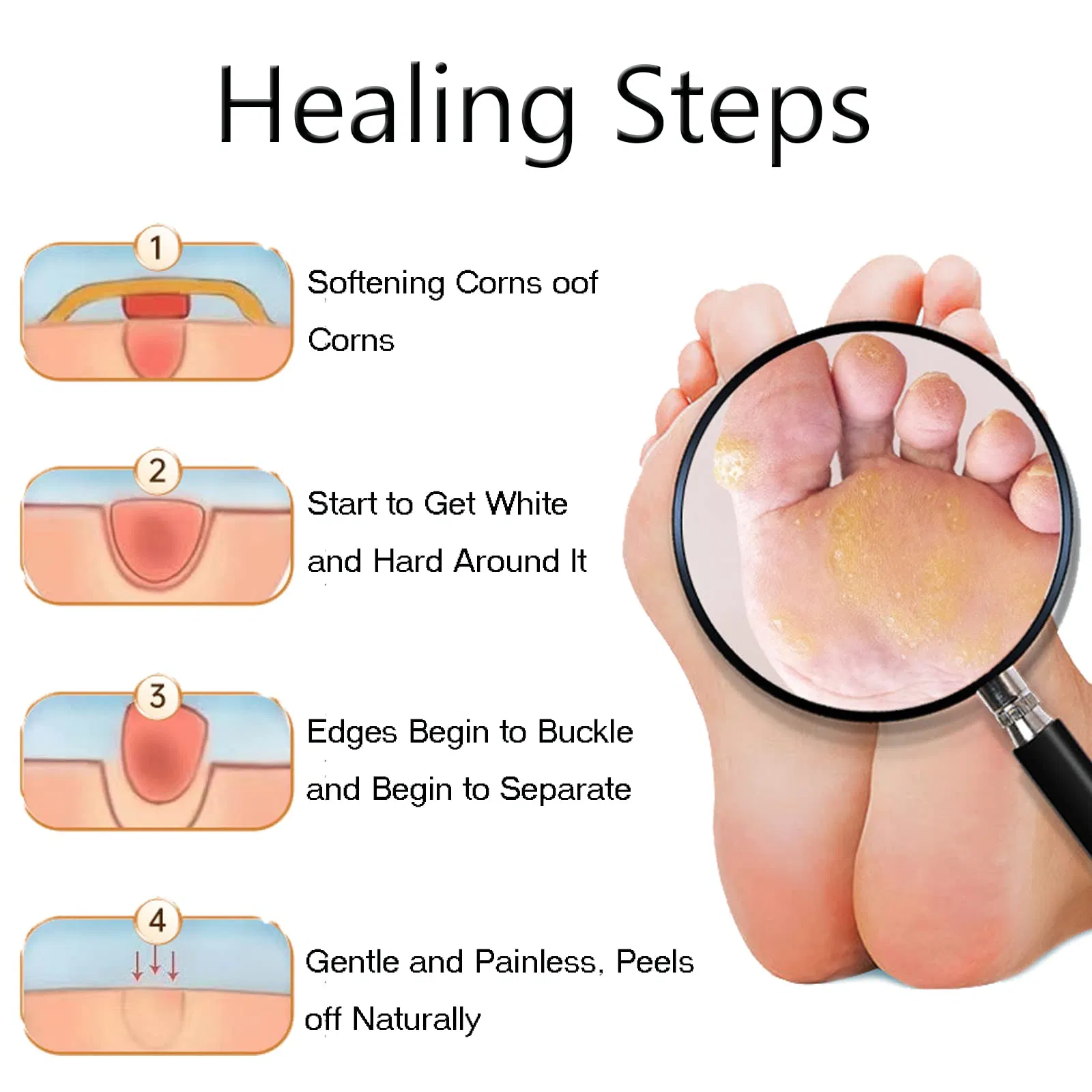 Corn Remover Plaster 1