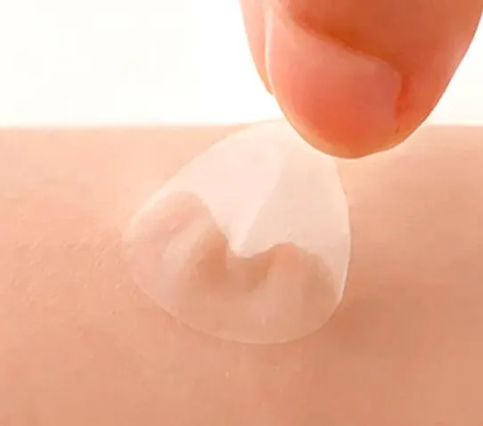 Acne Patch Product View 5