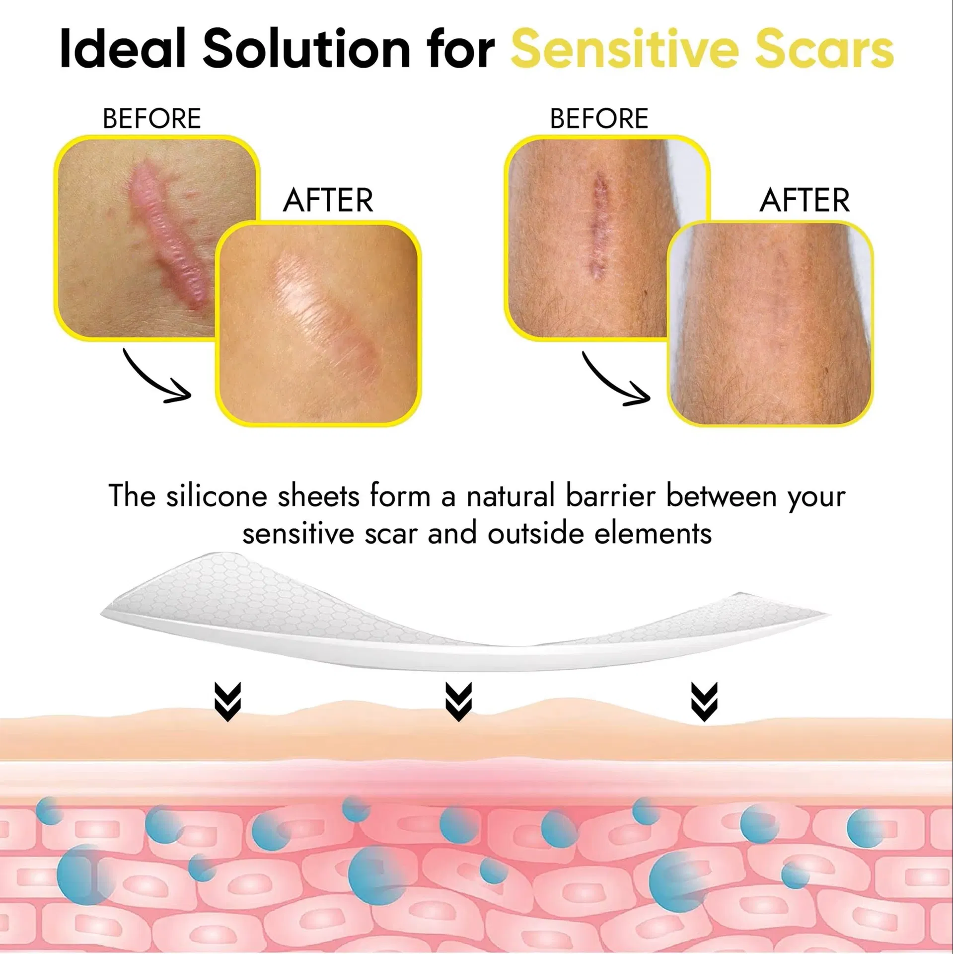 Wound Care Application