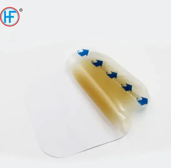 Hydrocolloid Dressing Detail 1