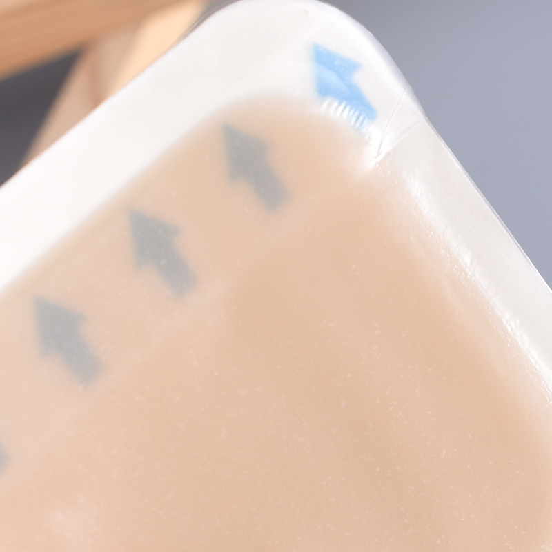 Bordered Fast Healing Hydrocolloid Dressing with High Quality