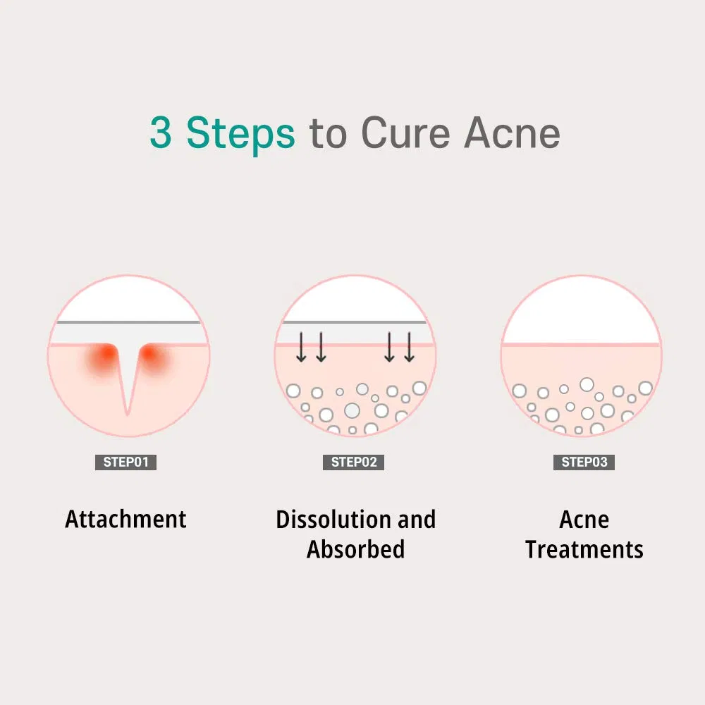 Microneedle Hydrocolloid Patch for Acne Pimple Treatment Beauty Products