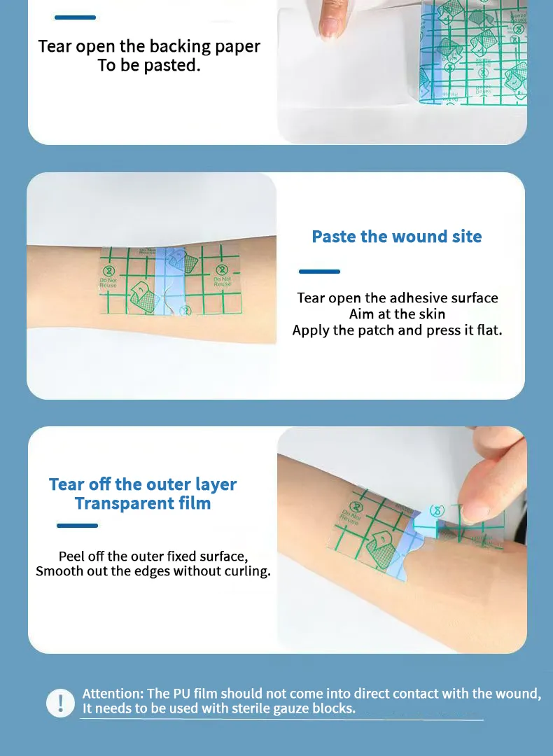 Wound Care Tape 10
