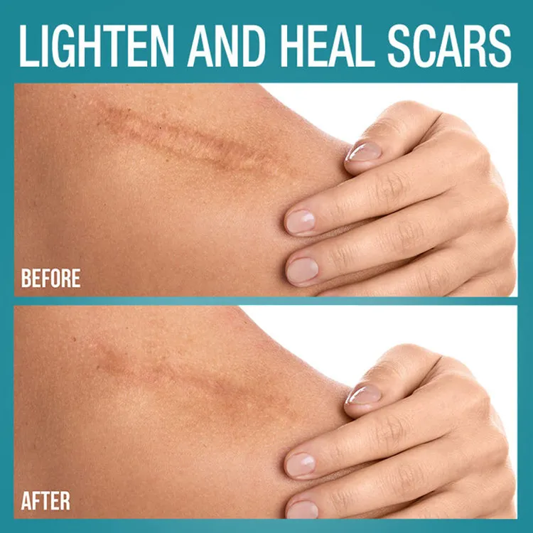 Silicone Scar Sheet 4