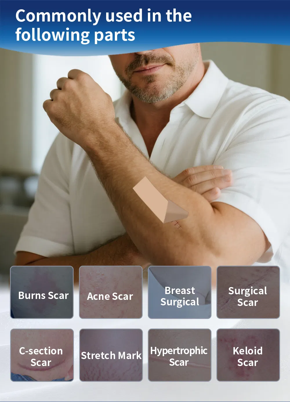 Scar Silicone Tape 4