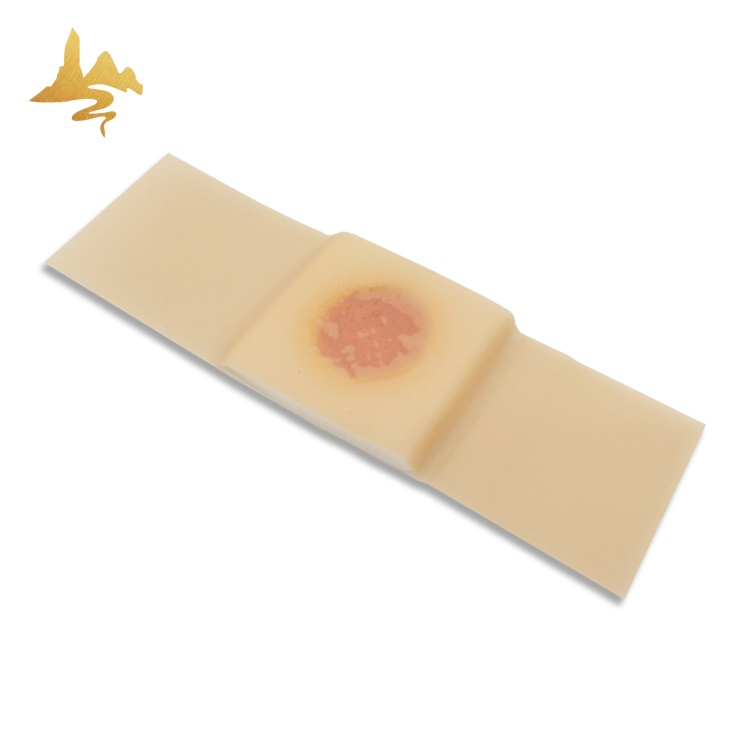 Foot Care Product Skin Color Transdermal Adults Corn Removal Plaster