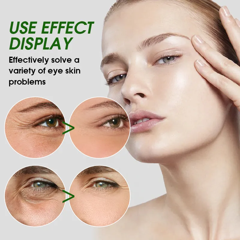 Collagen Eye Mask View 7