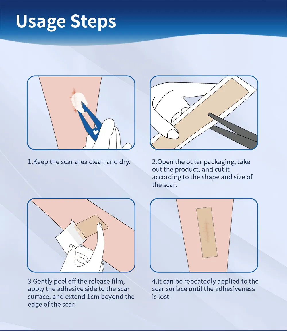 Scar Silicone Tape 5