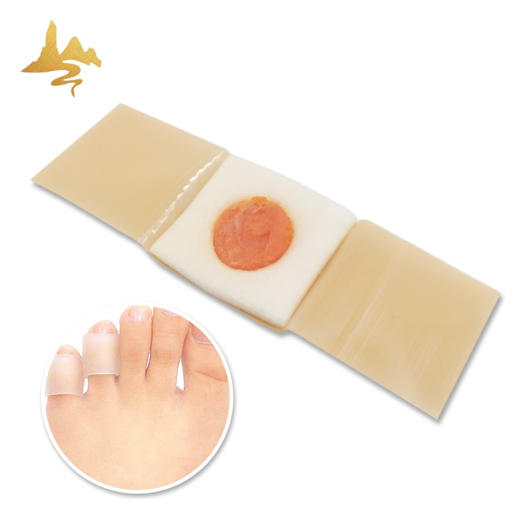 Health Care Suppliers Natural Herbal Reduce Foot Pain Warts Corn Removal Plaster
