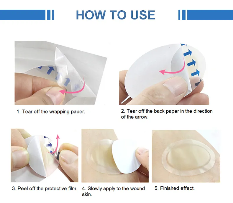 Hydrocolloid Wound Dressing 3