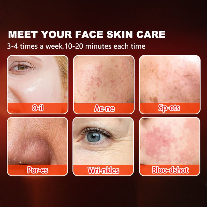 Red Light Therapy EMS Micro-Current Eye Massager New Dark Circle Remover Machine Under Removal Tool Anti Wrinkle LED Mask