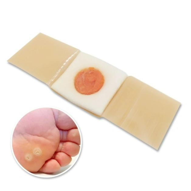 Wound Care Foot Chicken Eye Corn Removal Plaster