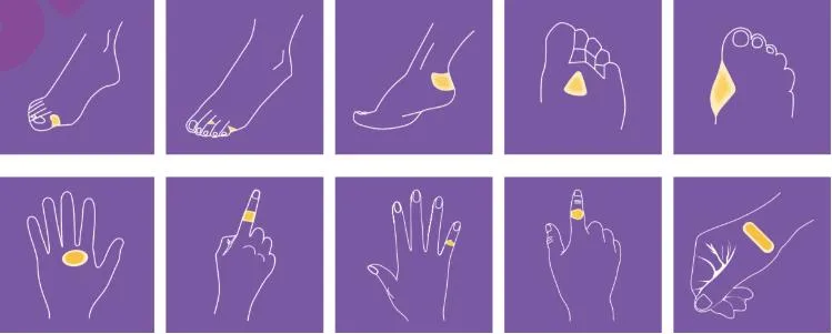 Blister Plaster Wide View