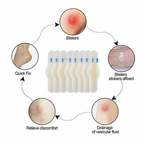 Hydrocolloid Wound Dressing