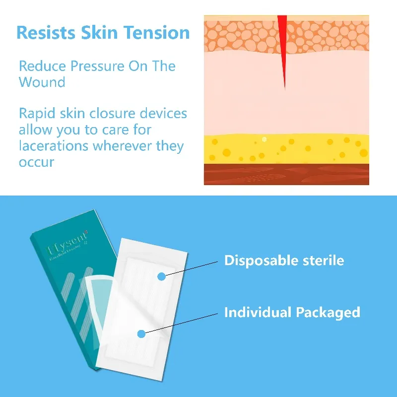 Wound Skin Closure Detailed View