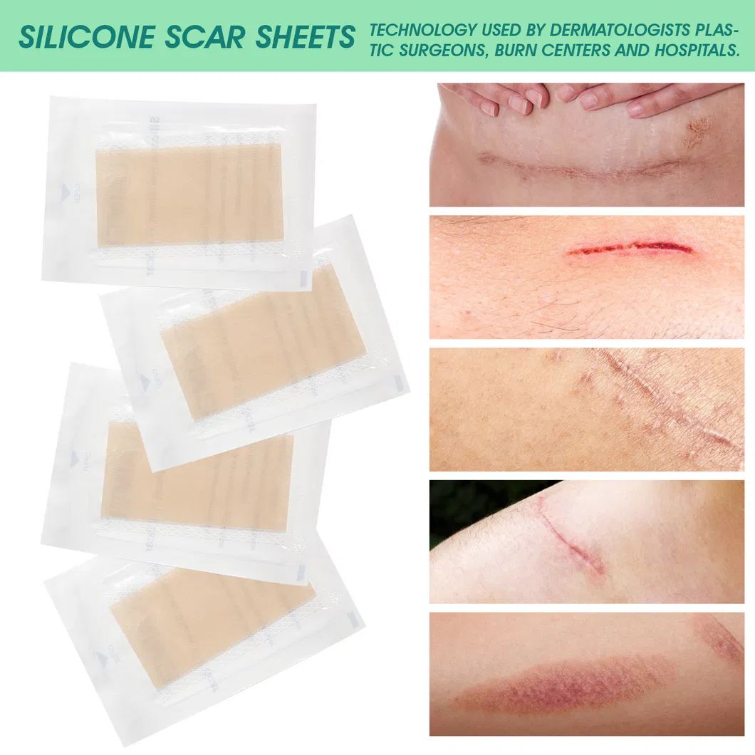 High Standard Sterile Universal Single Use Silicone Fading Dark Scar Sheet