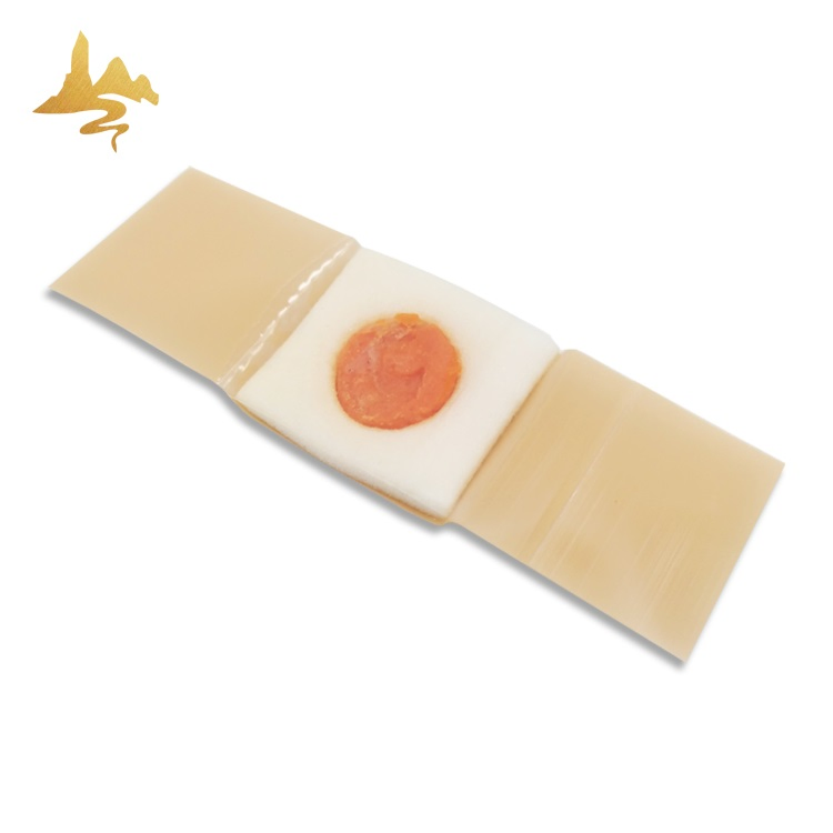 CE FDA ISO Approved Transdermal Foot Care Corn Removal Plaster