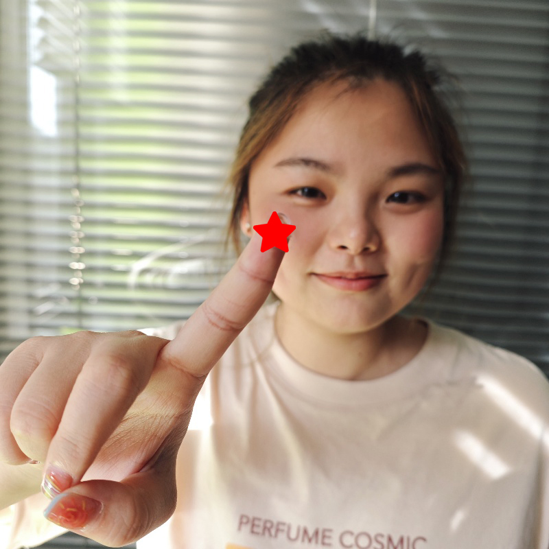 Premium Hydrocolloid Acne Pimple Patches for Fast Blemish Relief