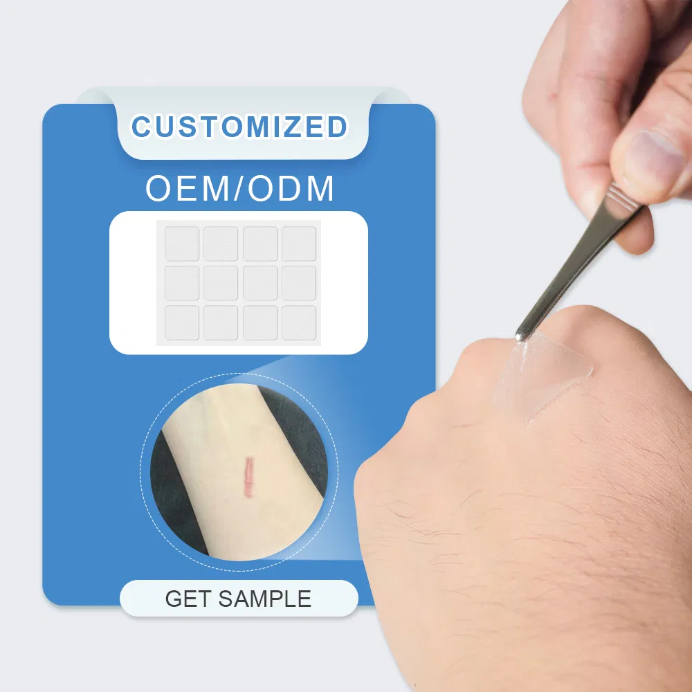 Soft Waterproof Adhesive Silicone Tape Medical Gel Film Scar Treatment Strips Removal Tape Sheet