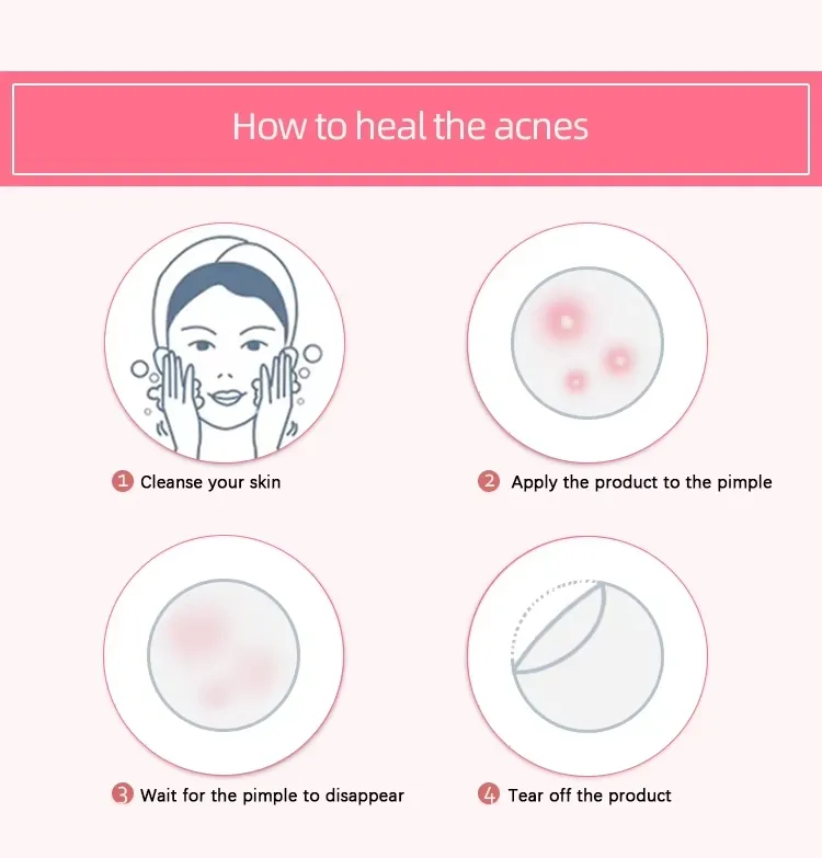 Pimple Treatment