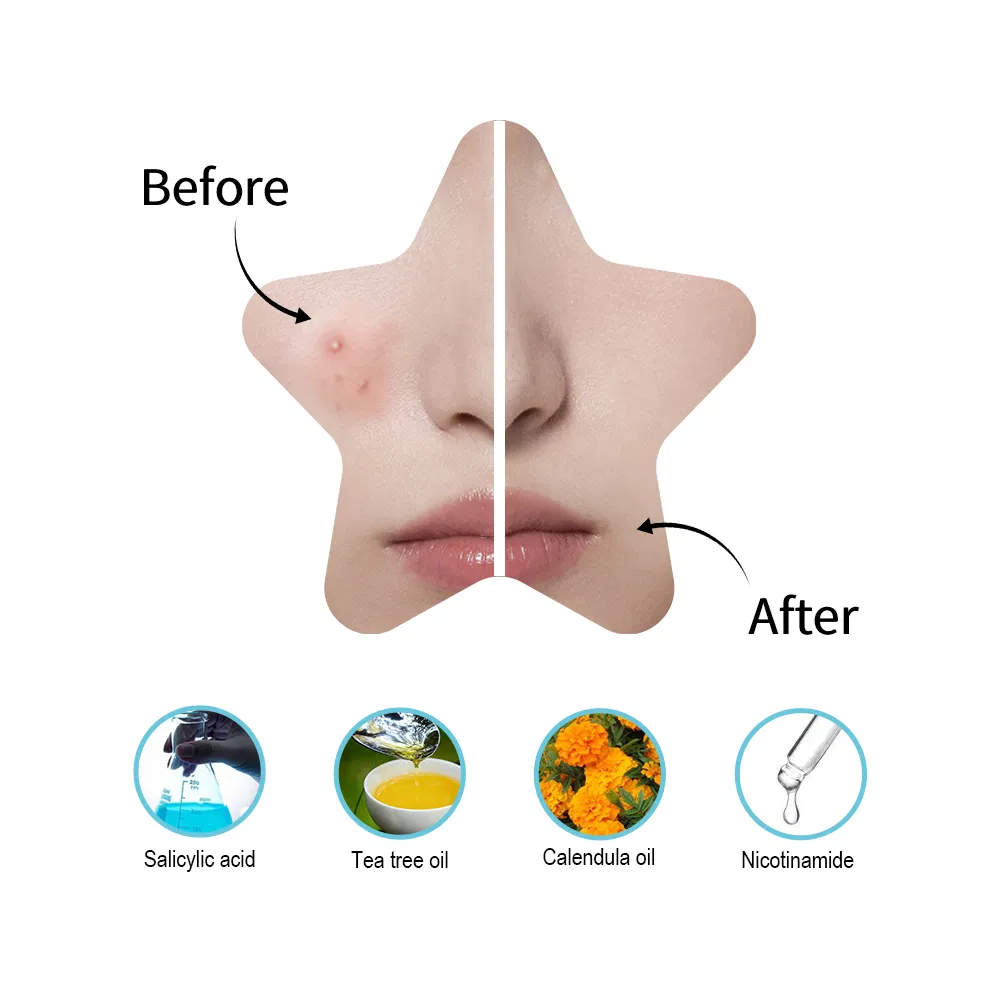 Star Shaped Acne Pimple Hydrocolloid Patches OEM Wholesale Private Label Patch Spot Cover