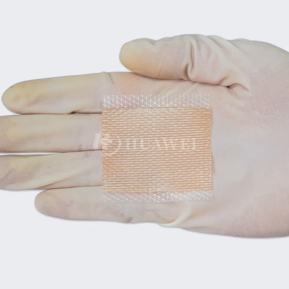 Medical Grade Scar Silicone Tape Gel Sheets Effective Burn Surgery Strips Removal for Acne Keloid Scars and Acne Scars