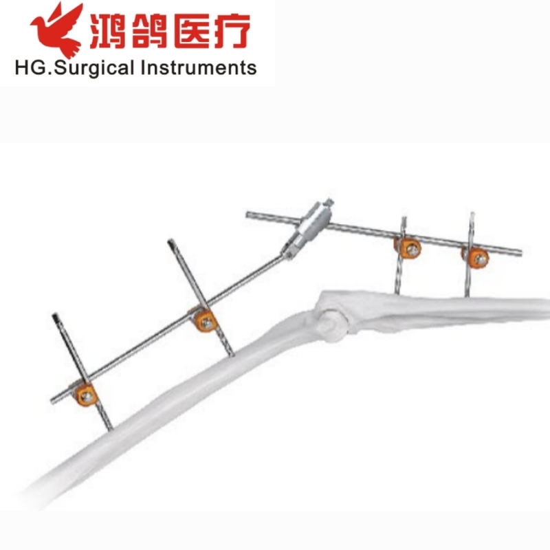 Orthopedic Combination External Fixator Forearm Fixator Orthopedic External Orthopedic Products Medical Instrument