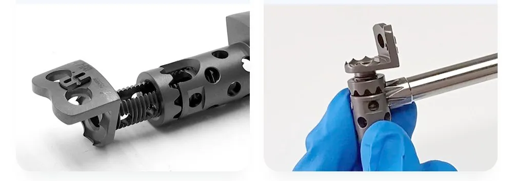 Surgical Safety Features