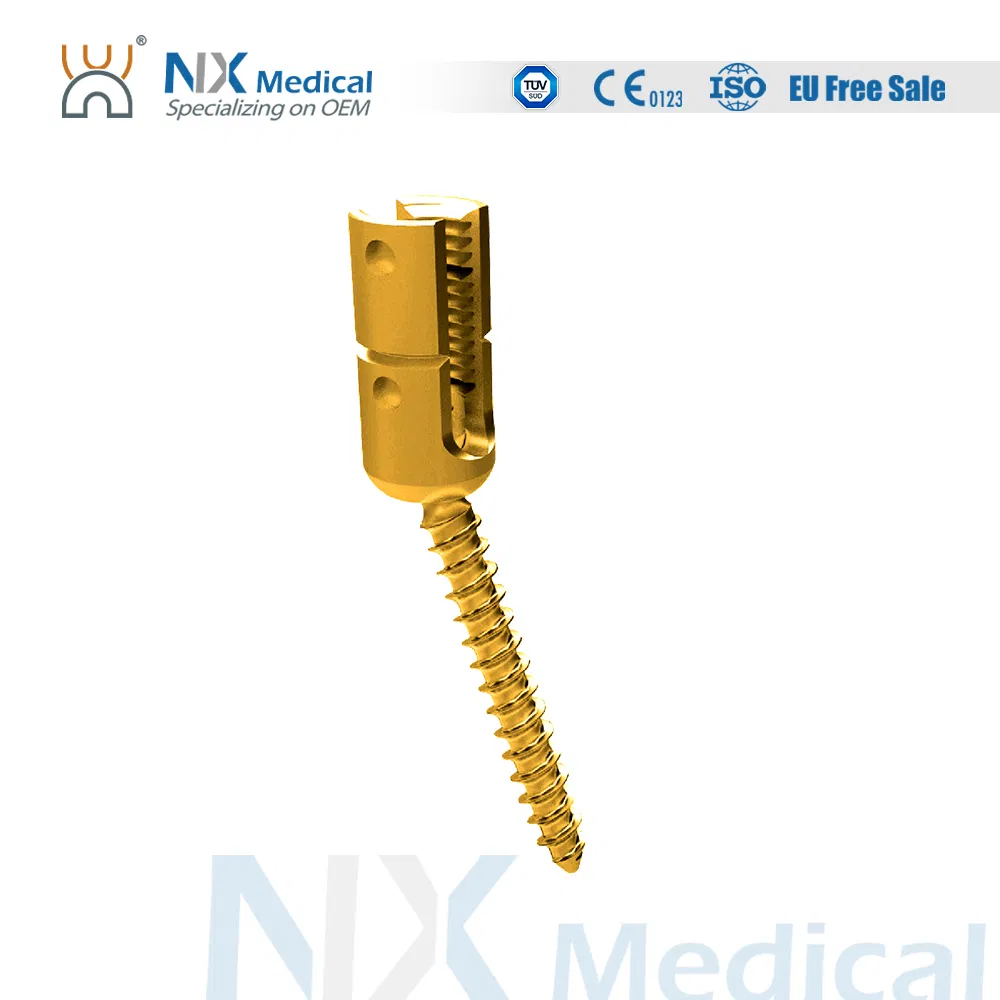 Nx Medical Orthopedic Implant Cannulated Bone Cement Spinal Pedicle Screw 6.0mm System
