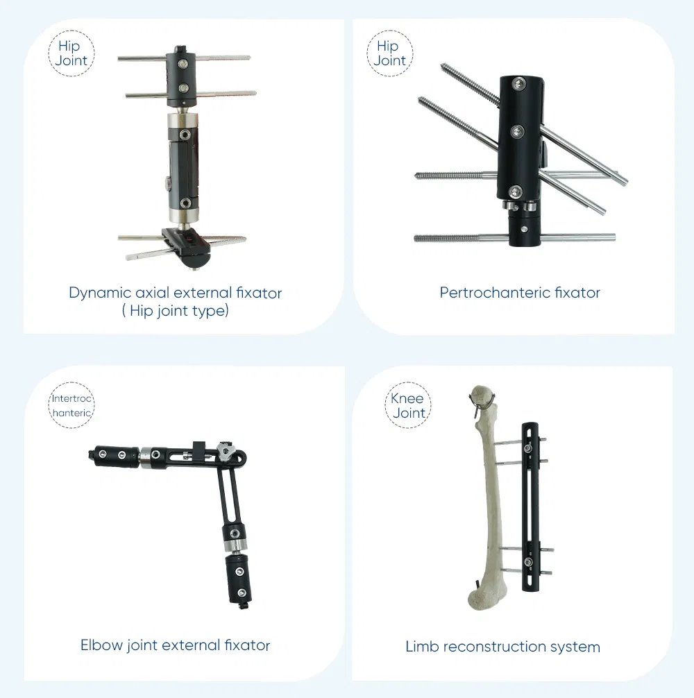 Xc Medico Orthopedic Medical Device Bone Fixation Tibia and Femur External Fixator