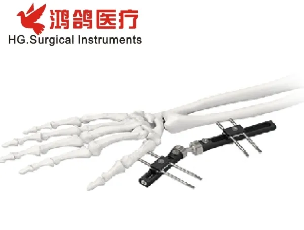 Orthopedic Mini Fixator 1