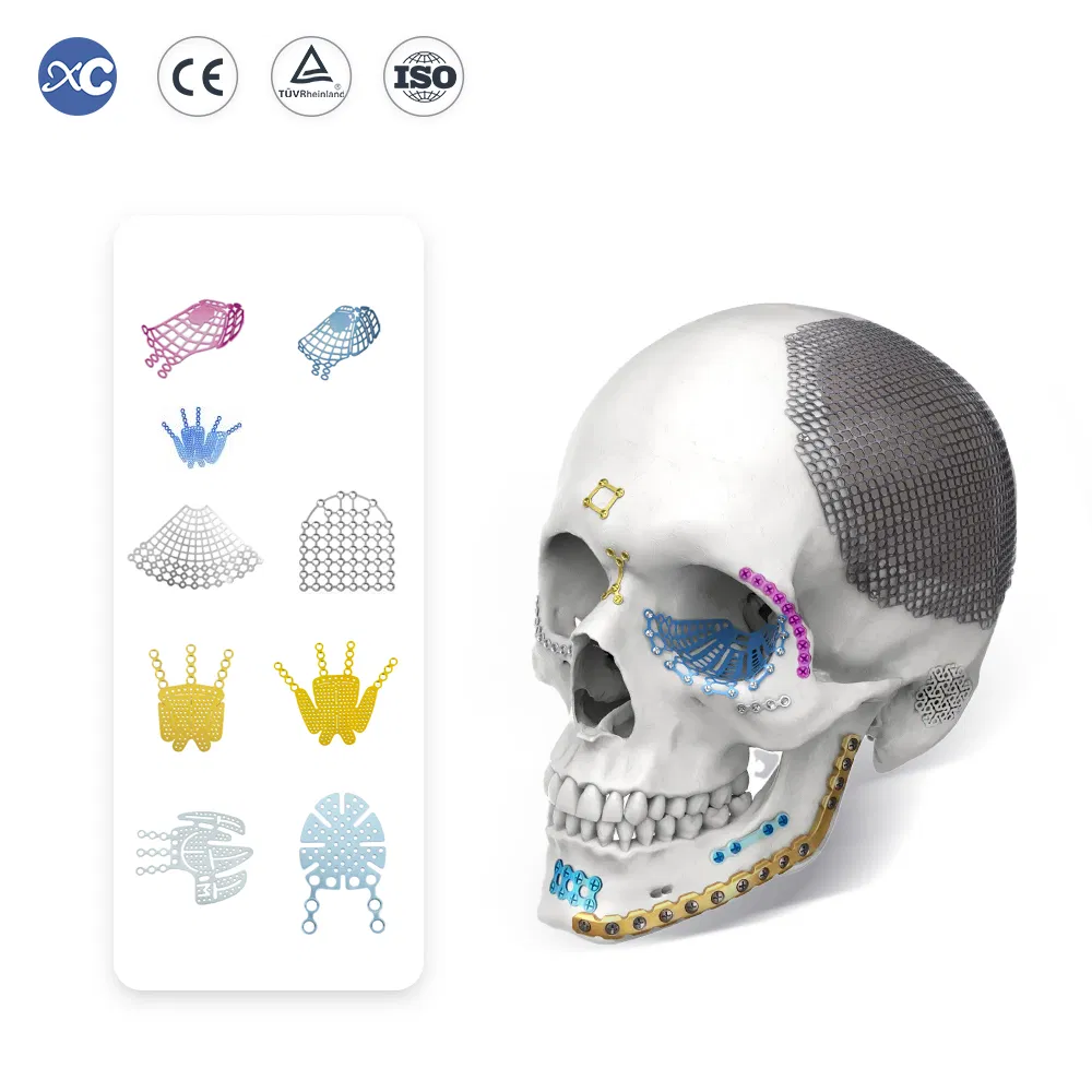 Wholesale 1.5mm Maxillofacial Titanium Mesh Implant Orthopedic Plate Orbital Floor Mesh