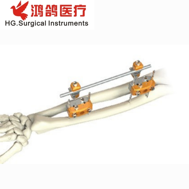 Orthopedic Combination External Fixator Forearm Fixator Orthopedic External Orthopedic Products Medical Instrument