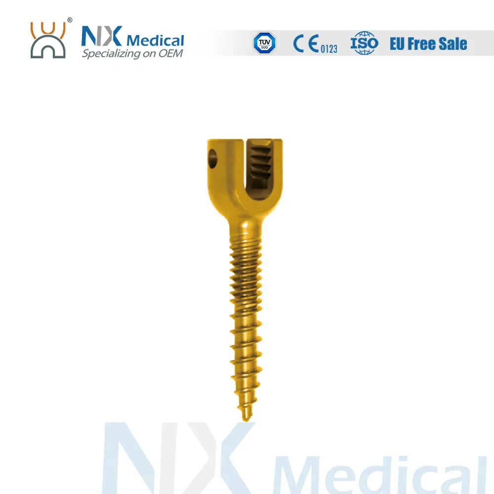Nx Medical Orthopedic Implant Cannulated Bone Cement Spinal Pedicle Screw 6.0mm System