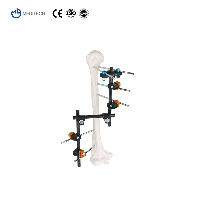 Meditech Factory Trauma Orthopedic External Fixation Orthopedic Implants External Fixator for Orthopedic Surgery