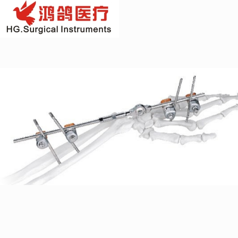 Orthopedic Combination External Fixator Forearm Fixator Orthopedic External Orthopedic Products Medical Instrument