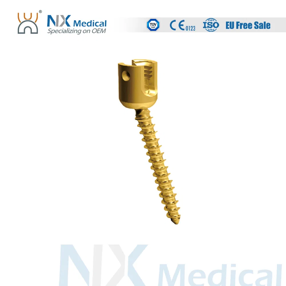 Nx Medical Orthopedic Implant Cannulated Bone Cement Spinal Pedicle Screw 6.0mm System
