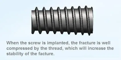 Screw Head Detail