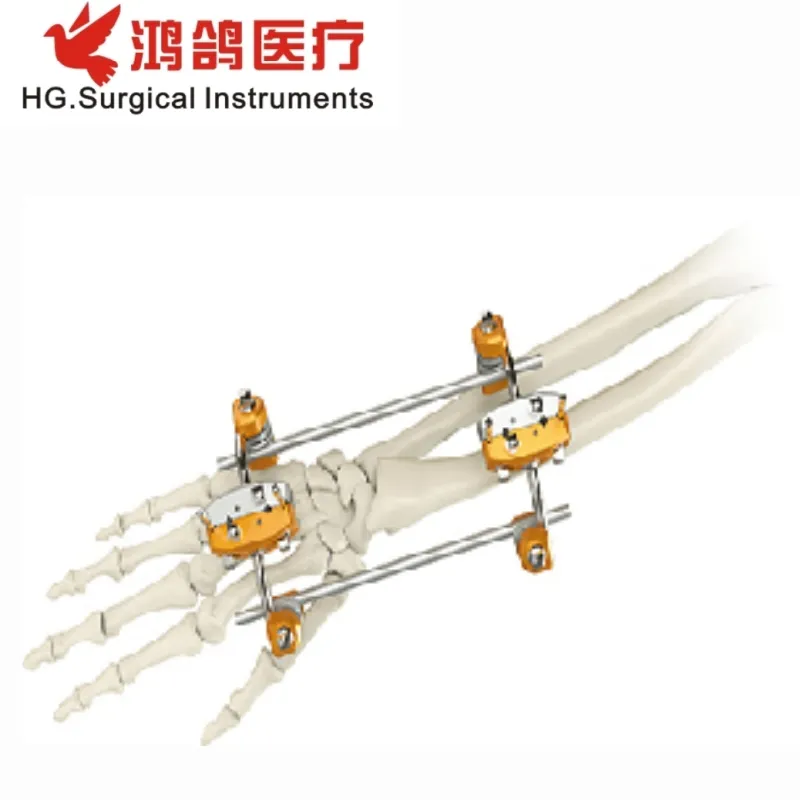 Orthopedic External Fixator 2