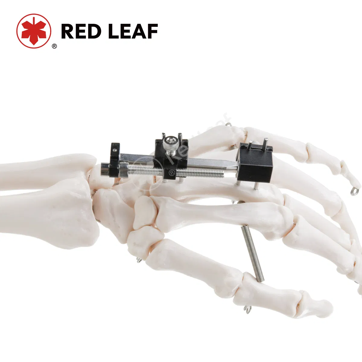 Mini Palm Fracture Medical Universal Compression Extension Finger External Fixator