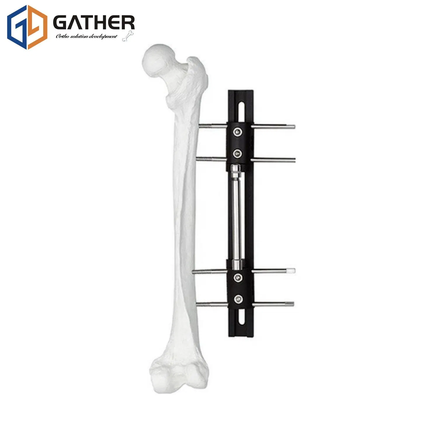 Pelvic Trauma Fixation Type External Fixator Tibia Fracture Medical
