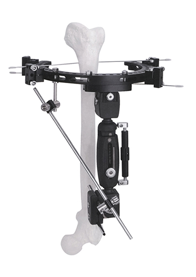 External Fixation Common Straight Fixator Orthopedic