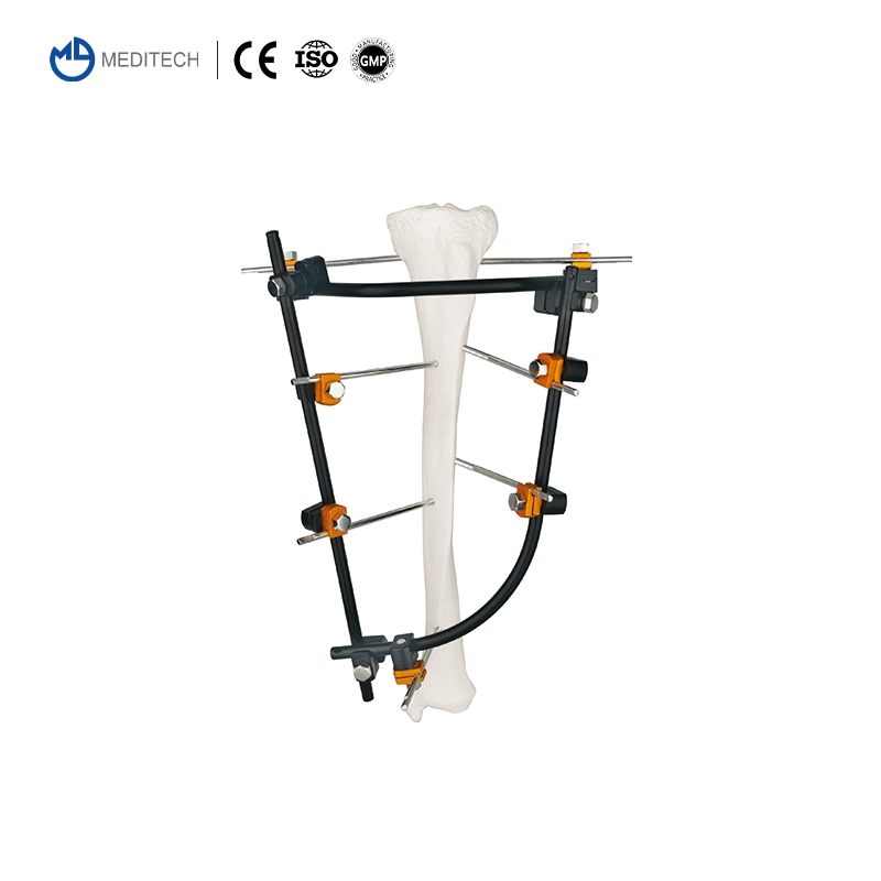 Meditech Factory Trauma Orthopedic External Fixation Orthopedic Implants External Fixator for Orthopedic Surgery