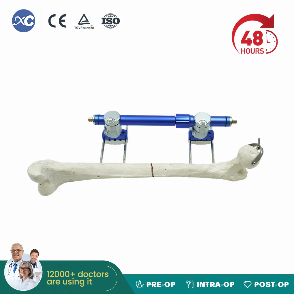 Xc Medico Orthopedic Medical Device Bone Fixation Tibia and Femur External Fixator