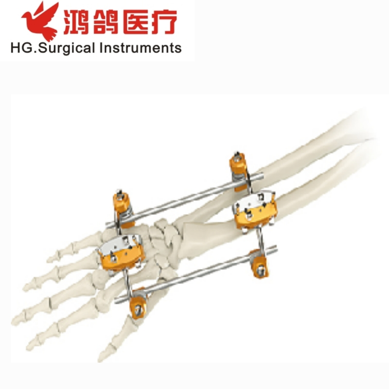 Orthopedic Combination External Fixator Forearm Fixator Orthopedic External Orthopedic Products Medical Instrument
