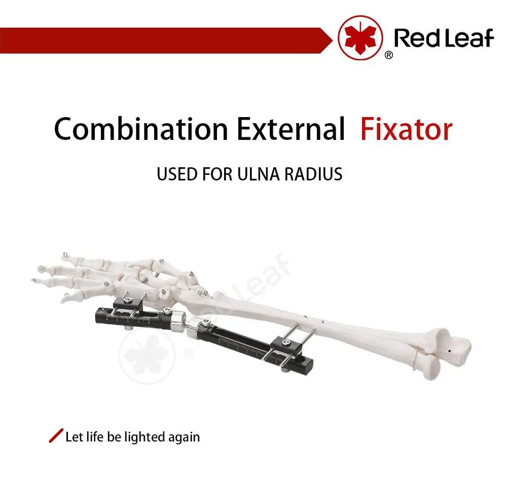 Wrist External Fixator Detail