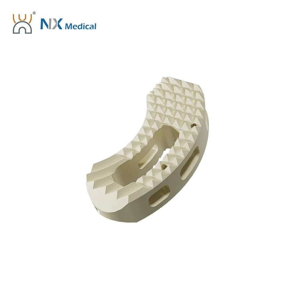 Nx Medical China Factory Titanium Tlif Cage Peek for Lumbar Interbody Fusion