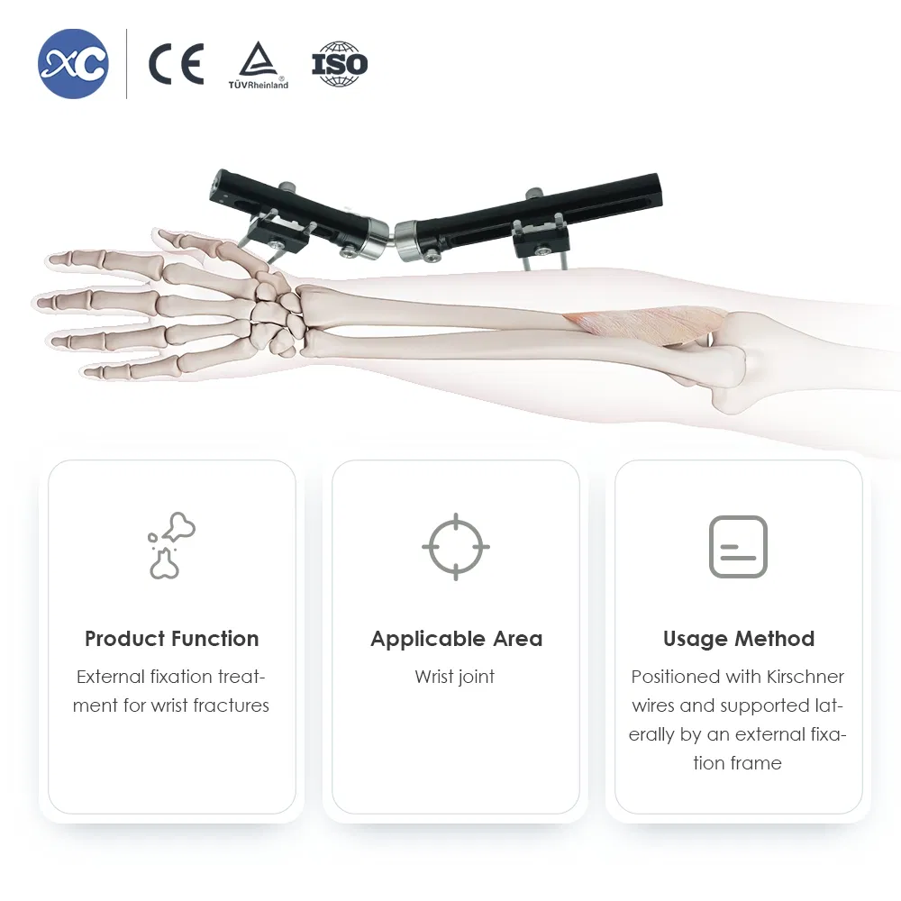 Wrist External Fixator Hand Bone Pin Stent Radius External Fixator